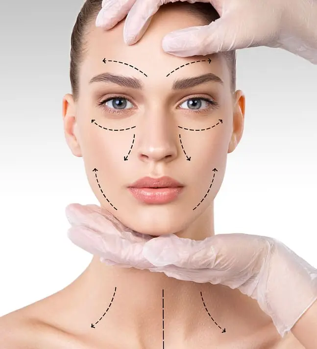 Ellanse Collagen Injections