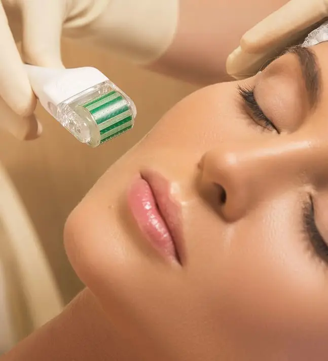 Micro Needle Treatment at Dermatox Aesthetics